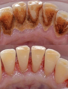 Slider image (9) Dr. Alejandra Rodarte Cosmetic & Implant Specialist